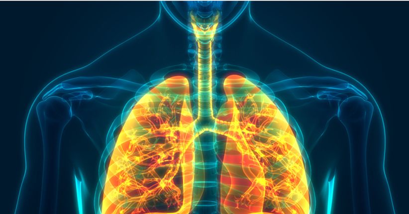 Doença pulmonar obstrutiva crônica