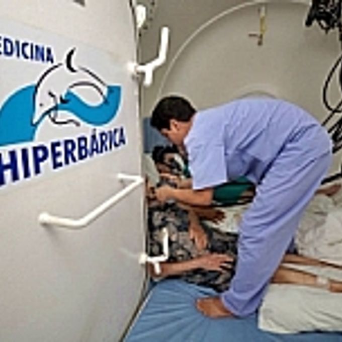 Câmara hiperbárica usada em Aracaju para tratar machucados em diabéticos
